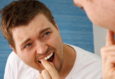Có nên bọc sứ cho răng cửa bị lung lay? (Ngọc Huyền-HN) 1