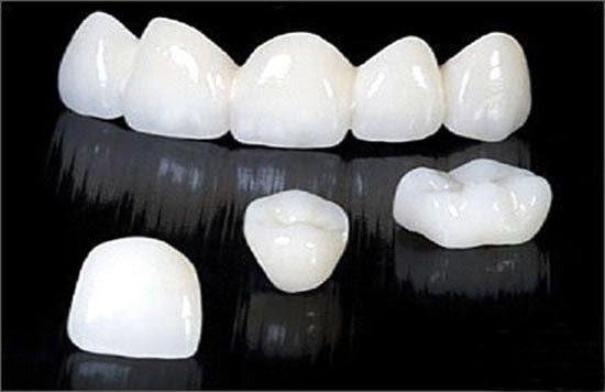 Tại sao nên chọn dòng răng sứ cao cấp để phục hình cho răng? 1