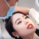 Video quy trình làm răng sứ