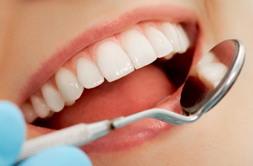 Có nên bọc răng sứ cho răng vỡ hay không? Chuyên gia tư vấn 2