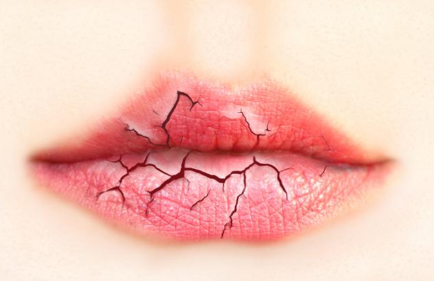 Khô miệng gây hôi miệng là bệnh gì và điều trị ra sao nhanh nhất? 1