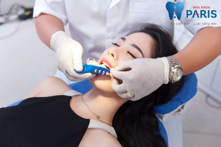 Bọc răng bị buốt - Nguyên nhân và cách phục hiệu quả nhanh nhất 2