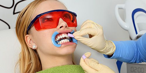 Ưu điểm của phương pháp tẩy trắng răng Laser Whitening