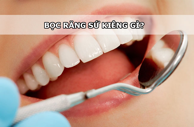 Bọc răng sứ kiêng gì? Loại răng sứ nào có độ bền chắc tốt nhất 1