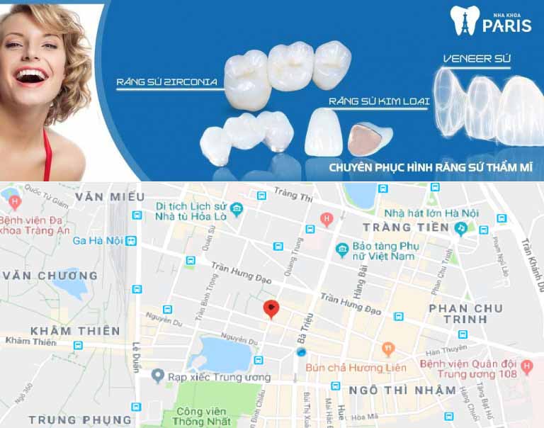 Bản đồ nha khoa: Chụp răng sứ uy tín và cam kết bảo hành tại Hà Nội