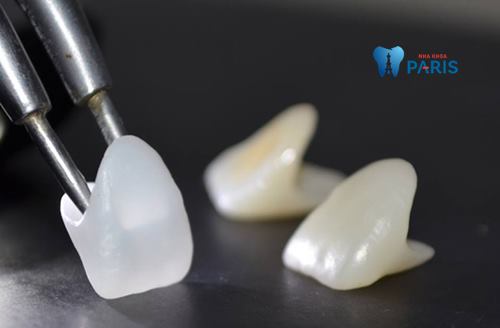 Độ bền chắc gấp 5 lần răng thật là ưu điểm của răng sứ Cercon