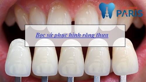 Nguyên nhân răng thưa & Cách làm răng KHÍT lại AN TOÀN hiệu quả 3