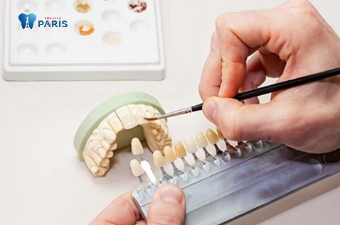Bọc răng sứ bị cộm do thiết kế răng sứ sai tỉ lệ, kích thước. 
